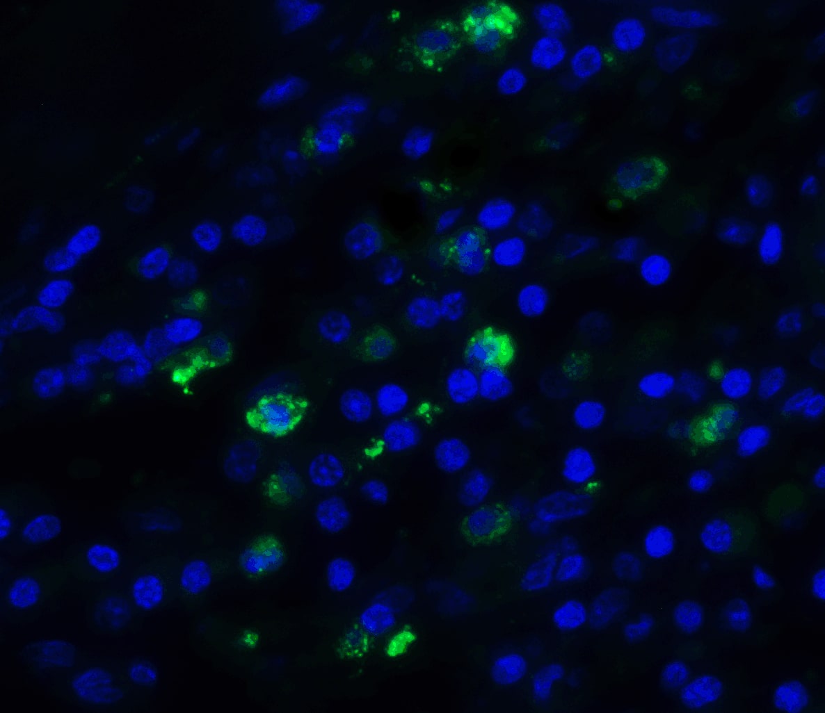 Immunocytochemistry/ Immunofluorescence: TFF3 Antibody - BSA Free [NBP1-76514] - Immunofluorescence of TFF3 in human small intestine tissue with TFF3 antibody at 20 ug/ml. Red: TFF3 Antibody   Blue: DAPI staining