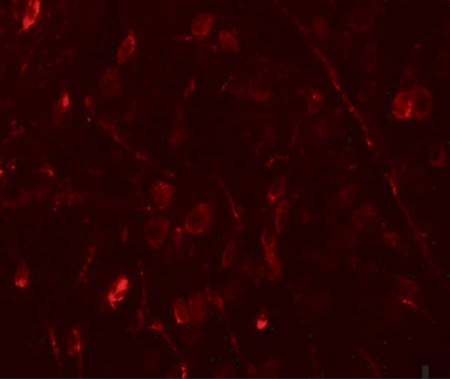 Immunocytochemistry/ Immunofluorescence: WIZ Antibody - BSA Free [NBP1-76515] - Immunofluorescence of WIZ in human brain tissue with WIZ antibody at 20 ug/mL.