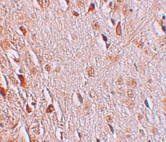Immunohistochemistry: WIZ Antibody - BSA Free [NBP1-76515] - Immunohistochemistry of WIZ in human brain tissue with WIZ antibody at 2.5 ug/mL.
