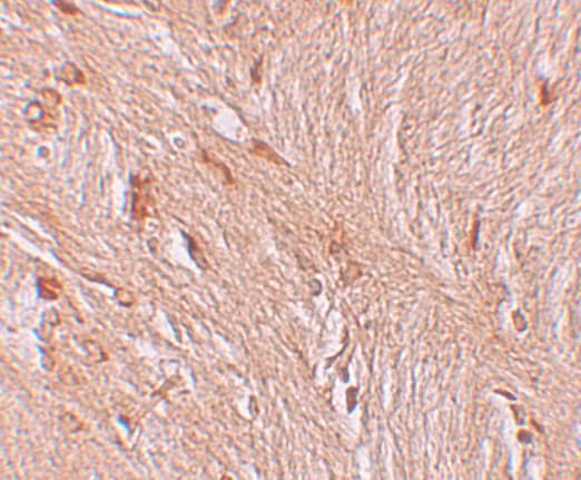 Immunohistochemistry: ZBTB3 Antibody - BSA Free [NBP1-76516] - Immunohistochemistry of ZBTB3 in human brain tissue with ZBTB3 antibody at 2.5 ug/mL.