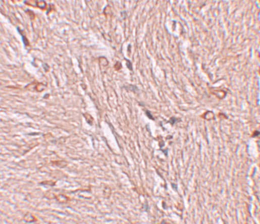 Immunohistochemistry ZBTB4 Antibody - BSA Free