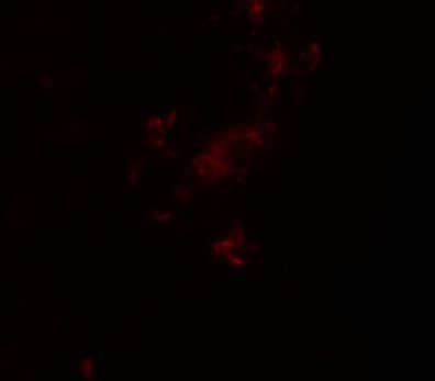 Immunocytochemistry/ Immunofluorescence: ZBTB5 Antibody - BSA Free [NBP1-76518] - Immunofluorescence of ZBTB5 in human brain tissue with ZBTB5 antibody at 20 ug/mL.