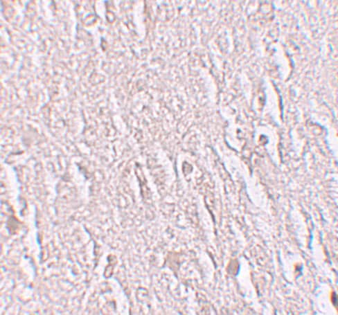 Immunohistochemistry: ZBTB5 Antibody - BSA Free [NBP1-76518] - Immunohistochemistry of ZBTB5 in human brain tissue with ZBTB5 antibody at 2.5 ug/mL.