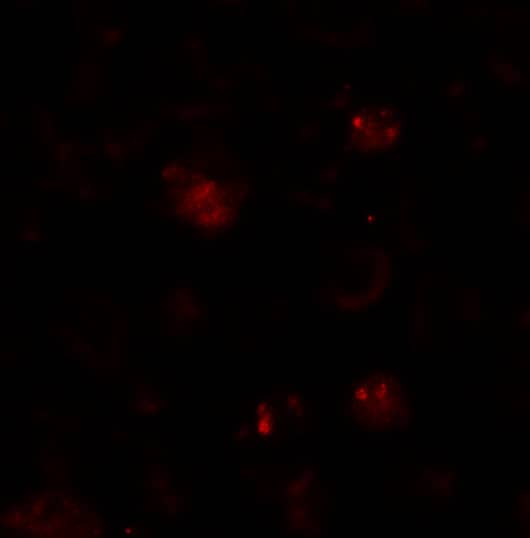 Immunocytochemistry/ Immunofluorescence: ZBTB6 Antibody - BSA Free [NBP1-76519] - Immunofluorescence of ZBTB6 in EL4 cells with ZBTB6 antibody at 20 ug/mL.