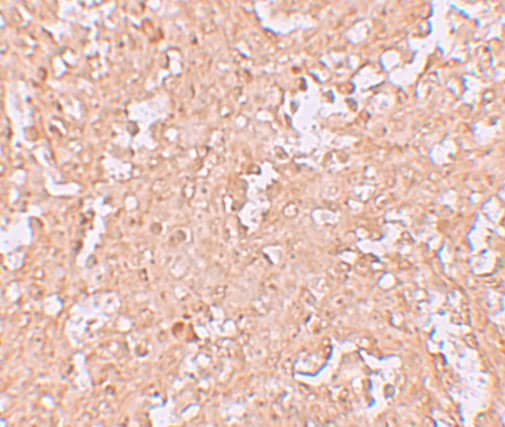 Immunohistochemistry: ZBTB8A Antibody - BSA Free [NBP1-76521] - Immunohistochemistry of ZBTB8A in human spleen tissue with ZBTB9 antibody at 2.5 ug/mL.