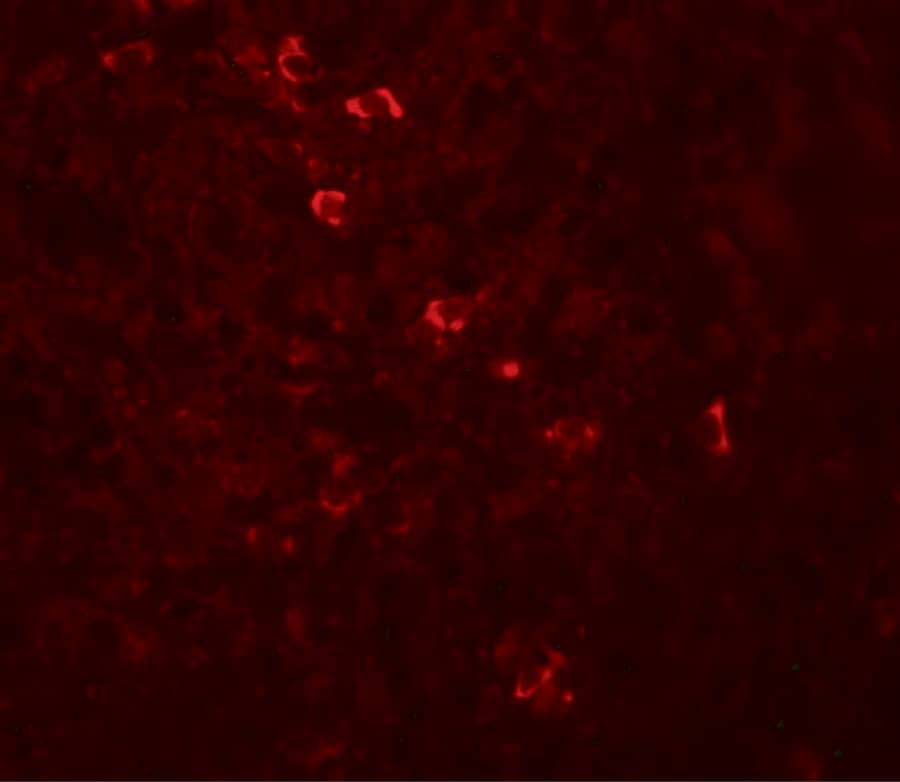 Immunocytochemistry/ Immunofluorescence: ZBTB8A Antibody - BSA Free [NBP1-76521] - Immunofluorescence ofZBTB8A in human spleen tissue with ZBTB8A antibody at 20 ug/mL.