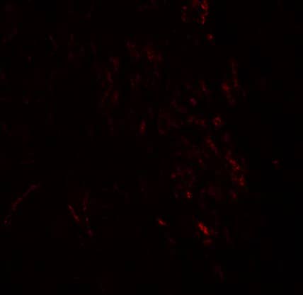 Immunocytochemistry/ Immunofluorescence: ZMYM3 Antibody - BSA Free [NBP1-76525] - Immunofluorescence of ZMYM3 in human brain tissue with ZMYM3 antibody at 20 ug/mL.