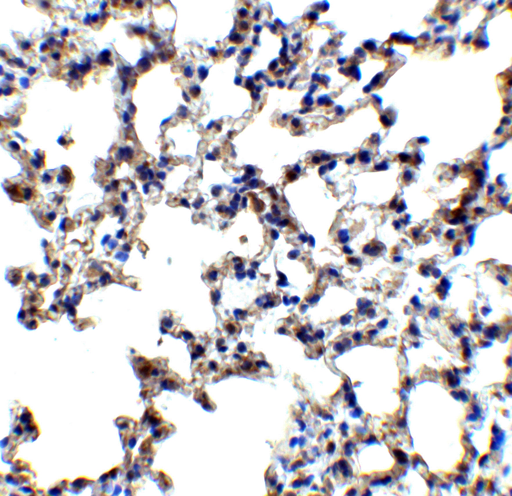 Immunohistochemistry: Axin-2 Antibody - BSA Free [NBP1-76526] - Immunohistochemistry of Axin-2 in mouse lung tissue with Axin-2 antibody at 5 ug/mL.