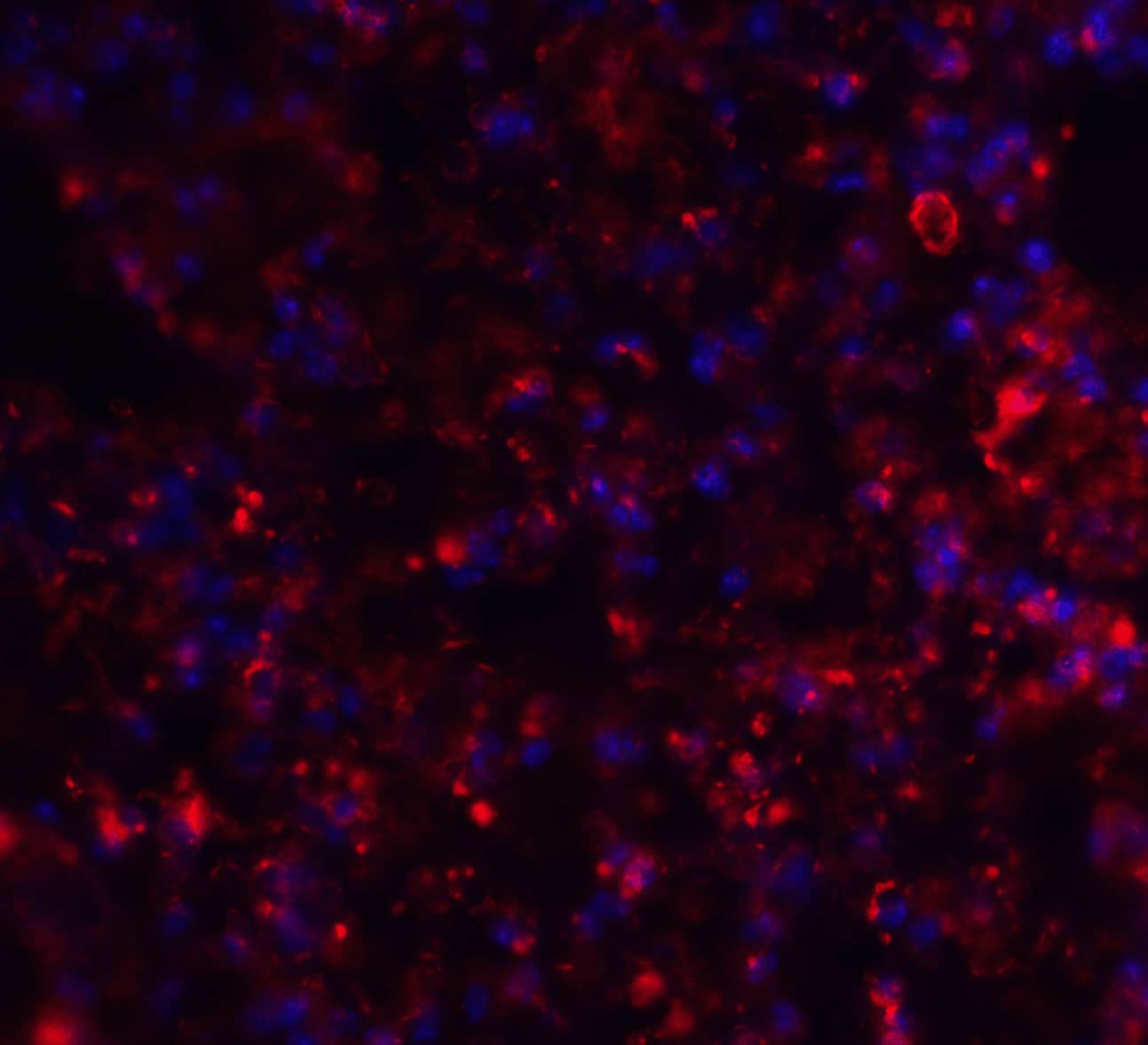 Immunocytochemistry/ Immunofluorescence Axin-2 Antibody - BSA Free