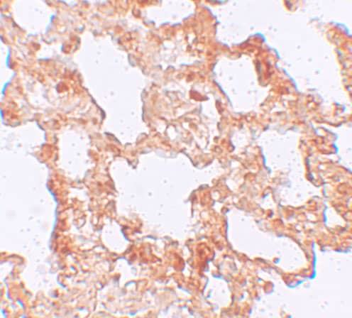 Immunohistochemistry Axin-2 Antibody - BSA Free