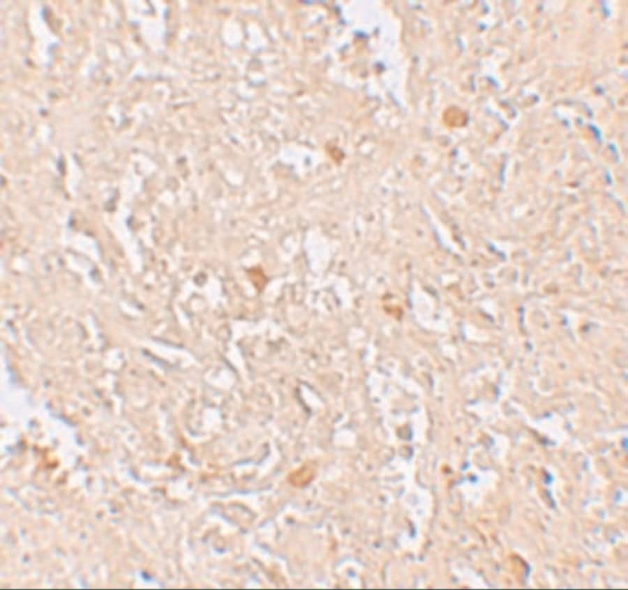 Immunohistochemistry: FBXL16 Antibody - BSA Free [NBP1-76527] - Immunohistochemistry of FBXL16 in human spleen tissue with FBXL16 antibody at 5 ug/mL.