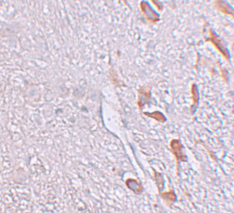Immunohistochemistry: LRRTM1 Antibody - BSA Free [NBP1-76528] - Immunohistochemistry of LRRTM1 in human brain tissue with LRRTM1 antibody at 5 ug/mL.