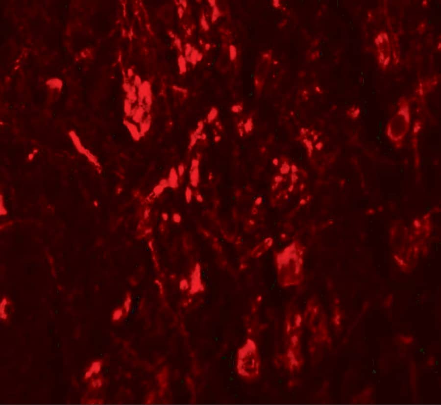 Immunocytochemistry/ Immunofluorescence: LRRTM4 Antibody - BSA Free [NBP1-76530] - Immunofluorescence of LRRTM4 in human brain tissue with LRRTM4 antibody at 20 ug/mL.
