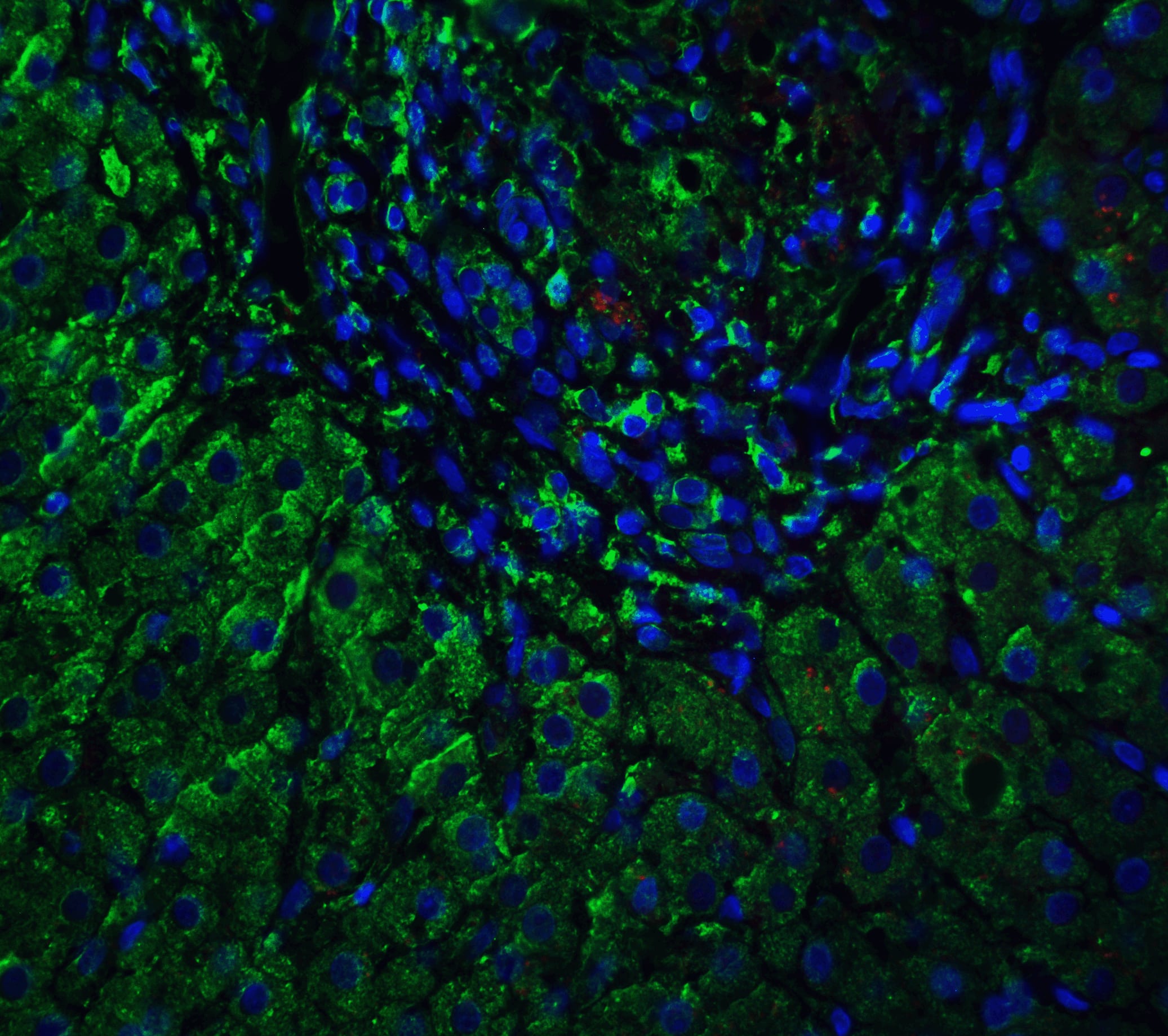 Immunocytochemistry/ Immunofluorescence VPS39 Antibody - BSA Free