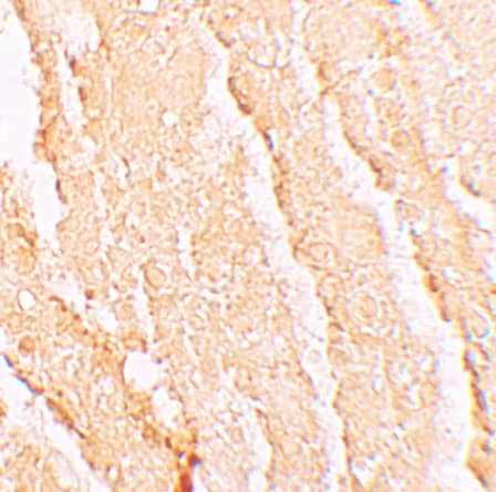 Immunohistochemistry VPS39 Antibody - BSA Free