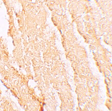 Immunohistochemistry: VPS39 Antibody - BSA Free [NBP1-76535] - Immunohistochemistry of VPS39 in mouse liver tissue with VPS39 antibody at 5 u/mL.