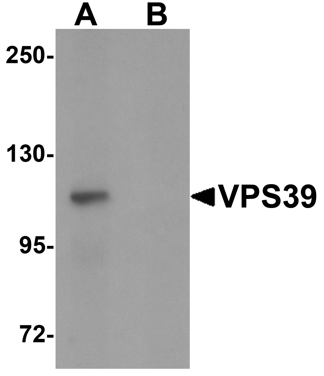 Western Blot: VPS39 Antibody - BSA Free [NBP1-76535] - Western blot analysis of VPS39 in rat liver tissue lysate with VPS39 antibody at 0.5 u/mL in (A) the absence and (B) the presence of blocking peptide.