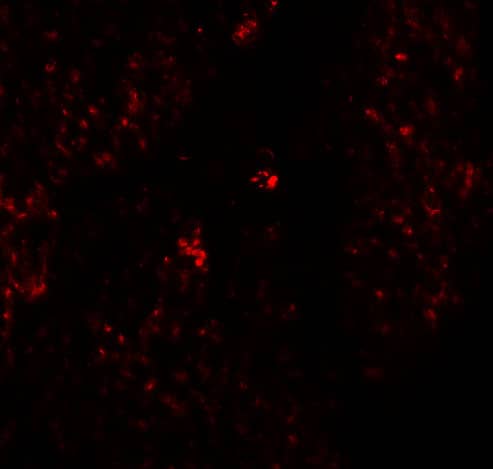 Immunocytochemistry/ Immunofluorescence RHAMM/CD168 Antibody - BSA Free