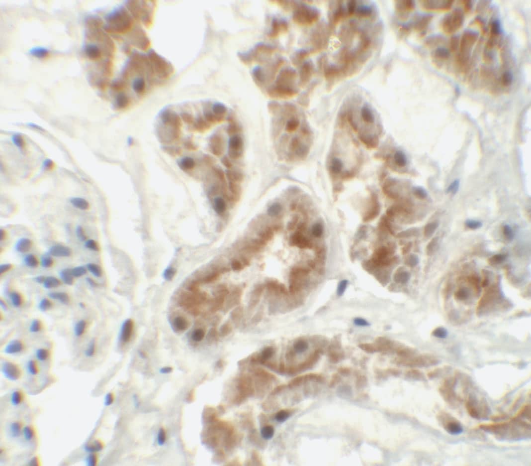 Immunohistochemistry ZNF346 Antibody - BSA Free