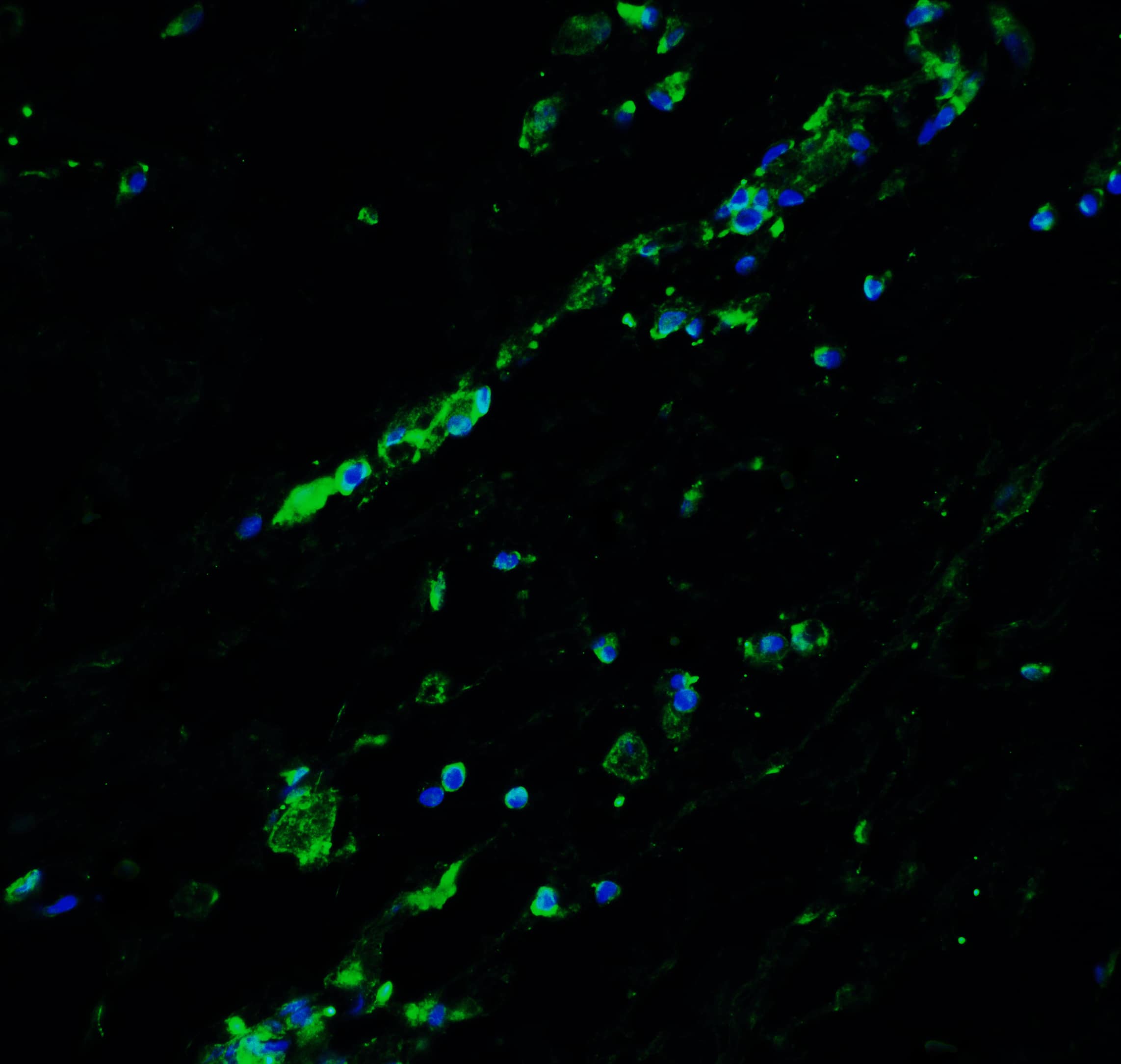 Immunocytochemistry/ Immunofluorescence: BCL9-2 Antibody - BSA Free [NBP1-76542] - Immunofluorescence of BCL9-2 in human breast tissue with BCL9-2 antibody at 20 u/ml.Green: BCL9-2 Antibody   Blue: DAPI staining