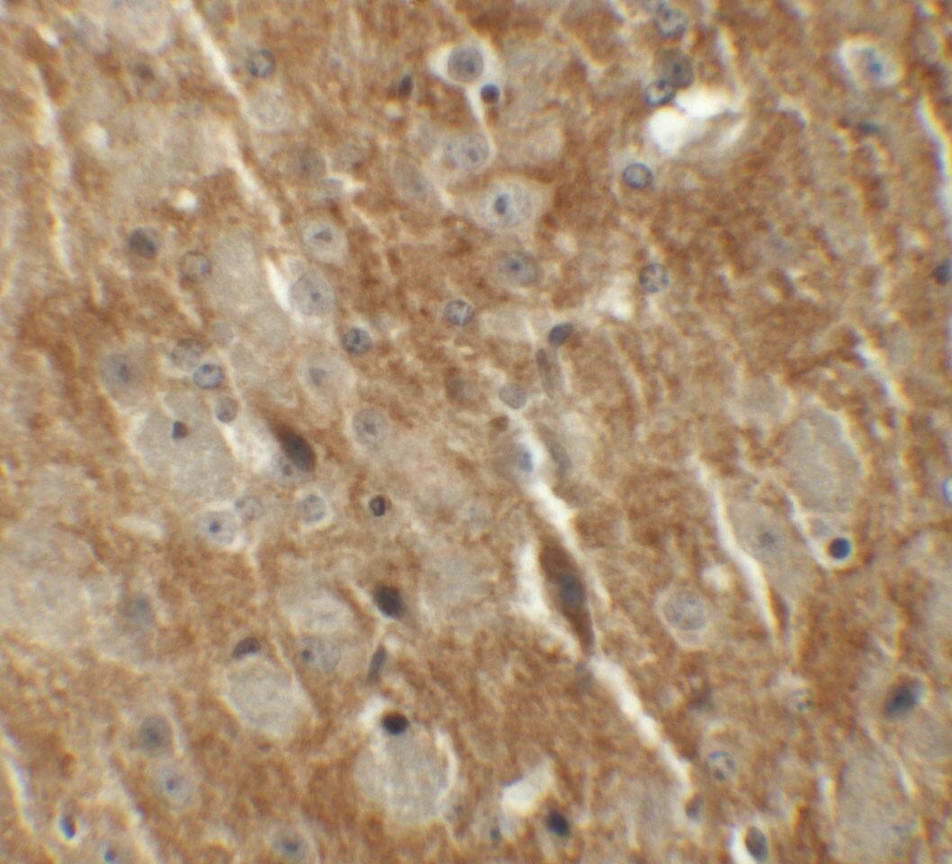 Immunohistochemistry: CTNNBL1 Antibody - BSA Free [NBP1-76543] - Immunohistochemistry of CTNNBL1 in mouse brain tissue with CTNNBL1 antibody at 5 u/mL.