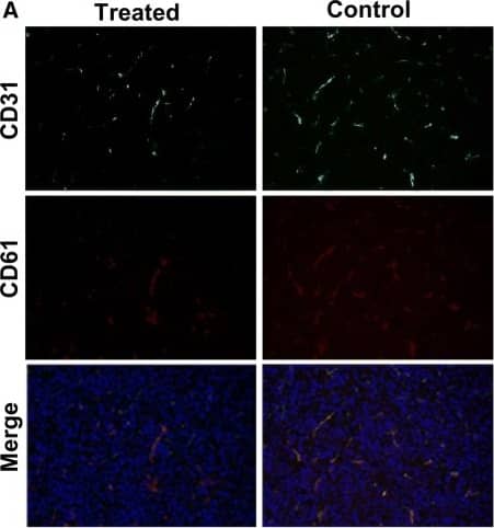 Immunocytochemistry/ Immunofluorescence: GLS2 Antibody - BSA Free [NBP1-76544] - Histological analyses for assessing response to bevacizumab treatment. A Immunofluorescence staining of tumor vasculature & integrin  beta 3 with antibodies against CD31 (green) & CD61 (integrin  beta 3, red) in the treated & control groups at the end of the study. B Quantitative analysis of integrin  beta 3 & CD31-positive area fraction of tumors between the control & treatment groups. **P < 0.05. Magnification: ×200. Microvascular density (CD31) from the therapy group (C) & control group (D). Tumor cell proliferation (Ki-67) from the therapy group (F) & control group (G). Quantitative MVD (E) & Ki67 (H) assessment of therapy & control group. Error bars denote standard errors, Mann–Whitney U-test were applied, **P < 0.05. Magnification: ×200 Image collected & cropped by CiteAb from the following publication (//pubmed.ncbi.nlm.nih.gov/31604441), licensed under a CC-BY license. Not internally tested by Novus Biologicals.