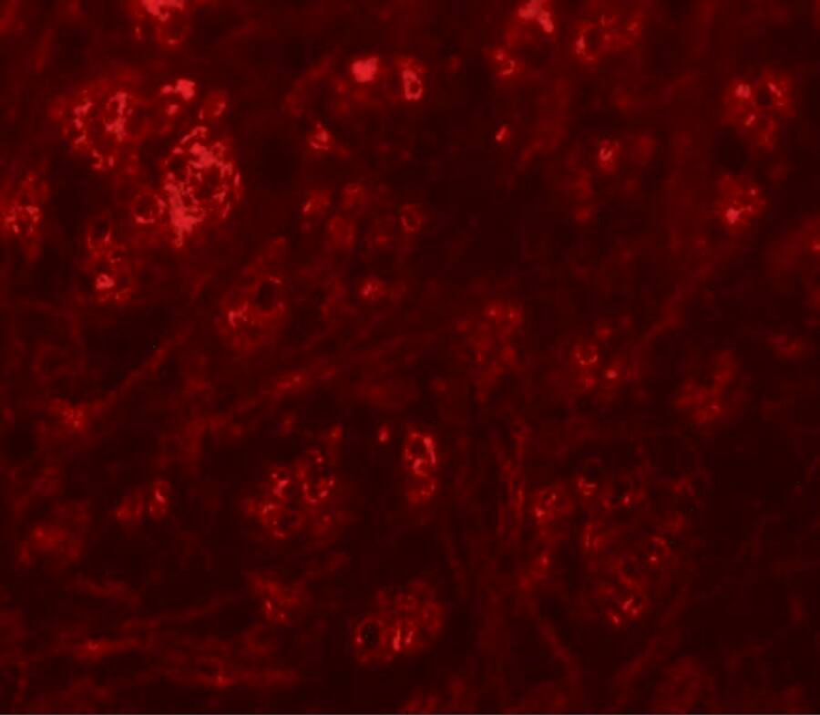 Immunocytochemistry/ Immunofluorescence: Rabex5 Antibody - BSA Free [NBP1-76548] - Immunofluorescence of Rabex5 in mouse brain tissue with Rabex5 antibody at 20 ug/mL.