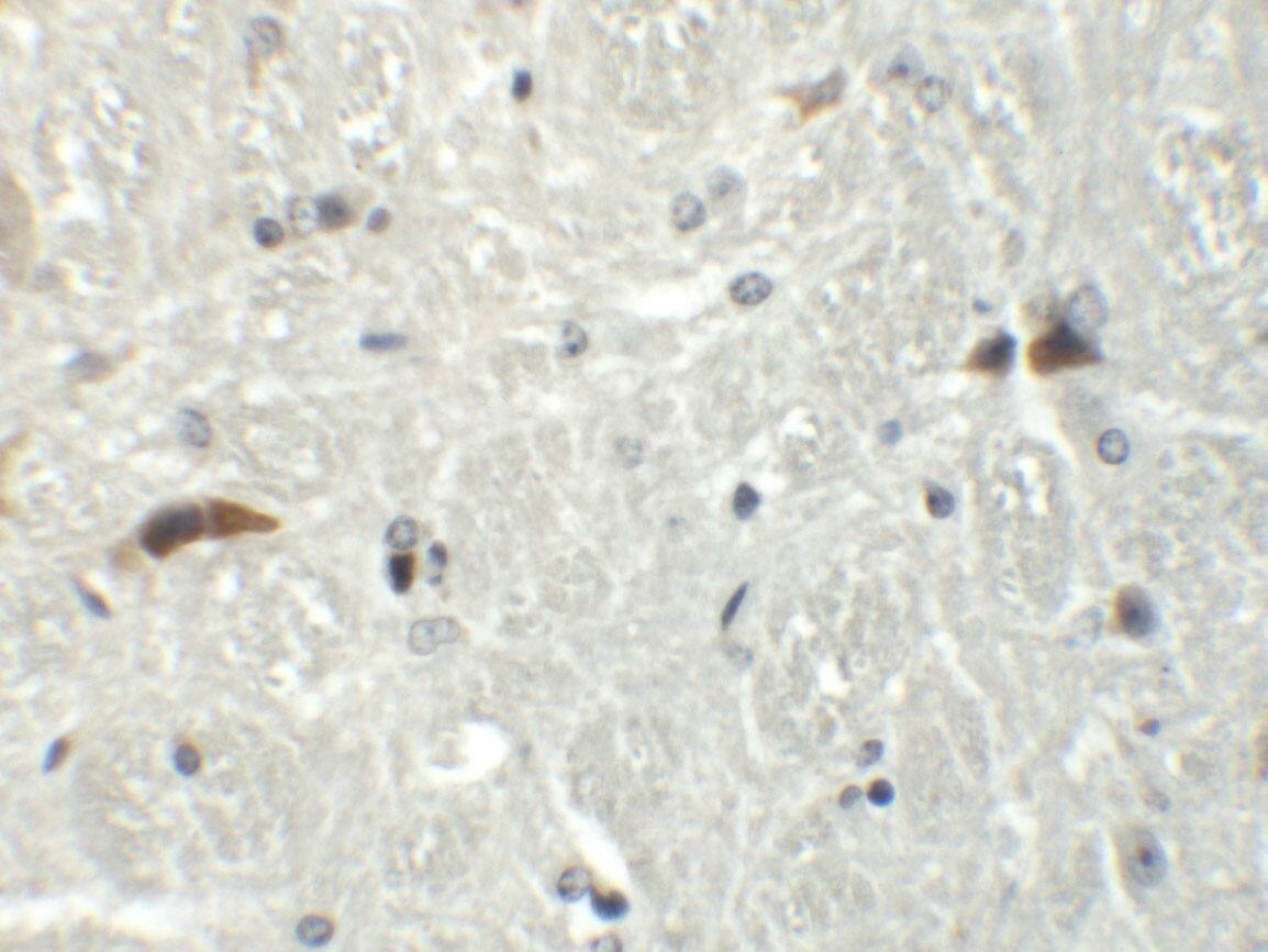 Immunohistochemistry: Rabex5 Antibody - BSA Free [NBP1-76548] - Immunohistochemistry of Rabex5 in mouse brain tissue with Rabex5 antibody at 5 ug/mL.