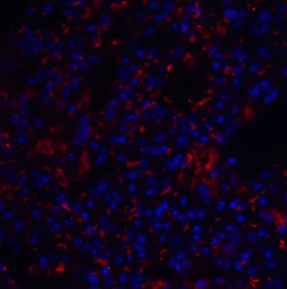 Immunocytochemistry/ Immunofluorescence: TM4SF1/L6 Antibody - BSA Free [NBP1-76549] - Immunofluorescence of TM4SF1/L6 in mouse lung tissue with TM4SF1/L6 antibody at 20 ug/mL.Red: TM4SF1/L6 Antibody   Blue: DAPI staining