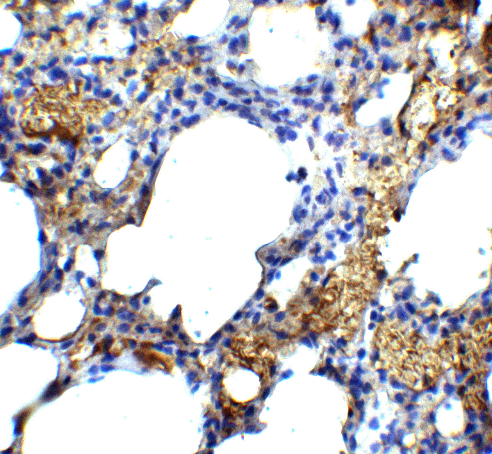 Immunohistochemistry: TM4SF1/L6 Antibody - BSA Free [NBP1-76549] - Immunohistochemistry of TM4SF1/L6 in mouse lung tissue with TM4SF1/L6 antibody at 5 ug/mL.