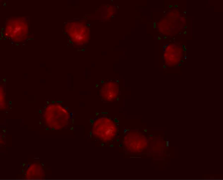 Immunocytochemistry/ Immunofluorescence: ZMIZ1/Zimp10 Antibody - BSA Free [NBP1-76553] - Immunofluorescence of ZMIZ1/Zimp10 in K562 cells with ZMIZ1/Zimp10 antibody at 20 ug/mL.