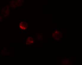 Immunocytochemistry/ Immunofluorescence: LIF Antibody - BSA Free [NBP1-76554] - Figure 6 Immunofluorescence Validation of LIF in Mouse 3T3 CellsImmunofluorescent analysis of 4% paraformaldehyde-fixed 3T3 cells labeling LIF with  at 20 u/mL, followed by goat anti-rabbit IgG secondary antibody at 1/500 dilution (red).  