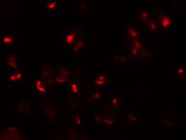 Immunocytochemistry/ Immunofluorescence: CD229/SLAMF3/Lymphocyte Antigen 9 Antibody - BSA Free [NBP1-76557] - Immunofluorescence of CD229/SLAMF3/Lymphocyte Antigen 9 in 293 cells with CD229/SLAMF3/Lymphocyte Antigen 9 antibody at 20 u/mL.