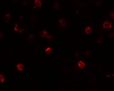 Immunocytochemistry/ Immunofluorescence: 2B4/CD244/SLAMF4 Antibody - BSA Free [NBP1-76558] - Immunofluorescence of 2B4/CD244/SLAMF4 in Daudi cells with 2B4/CD244/SLAMF4 antibody at 20 ug/mL.