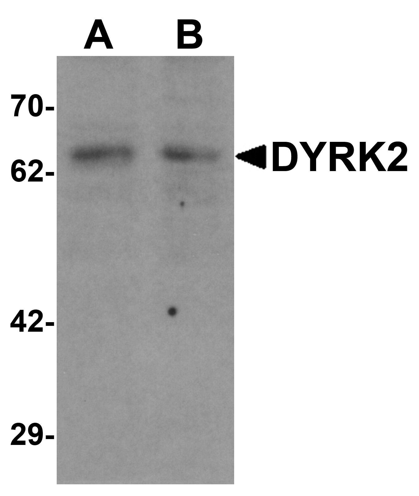 Western Blot: DYRK2 Antibody - BSA Free [NBP1-76560] - Western blot analysis of DYRK2 in 293 cell lysate with DYRK2 antibody at (A) 1 and (B) 2 u/mL.