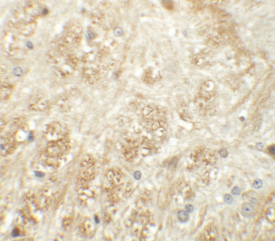 Immunohistochemistry ATP2C1 Antibody - BSA Free