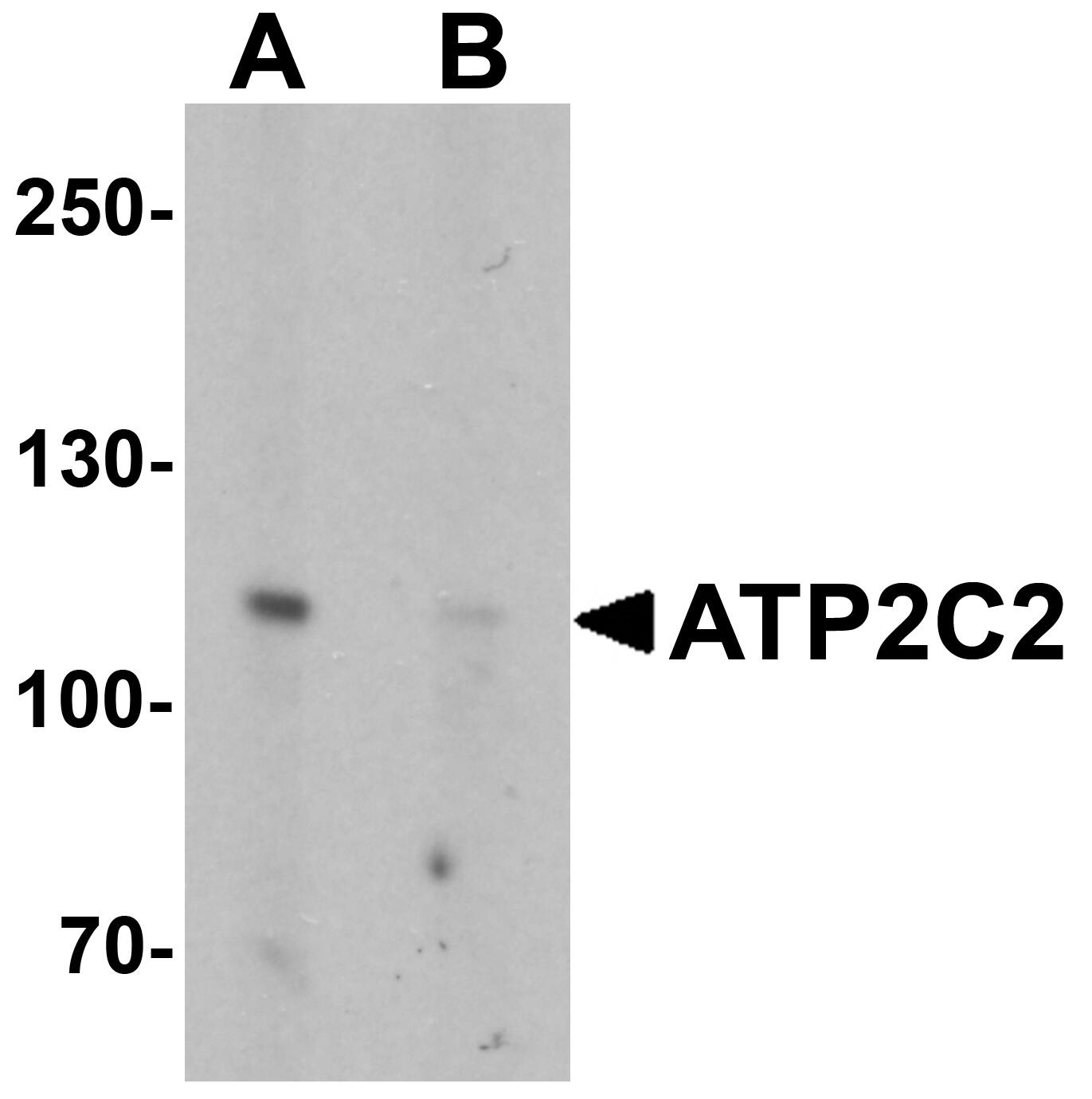 Western Blot: ATP2C2 Antibody Blocking Peptide [NBP1-76567PEP] - Western blot analysis of ATP2C2 in 3T3 cell lysate with ATP2C2 antibody at 1 u/mL in (A) the absence and (B) the presence of blocking peptide.