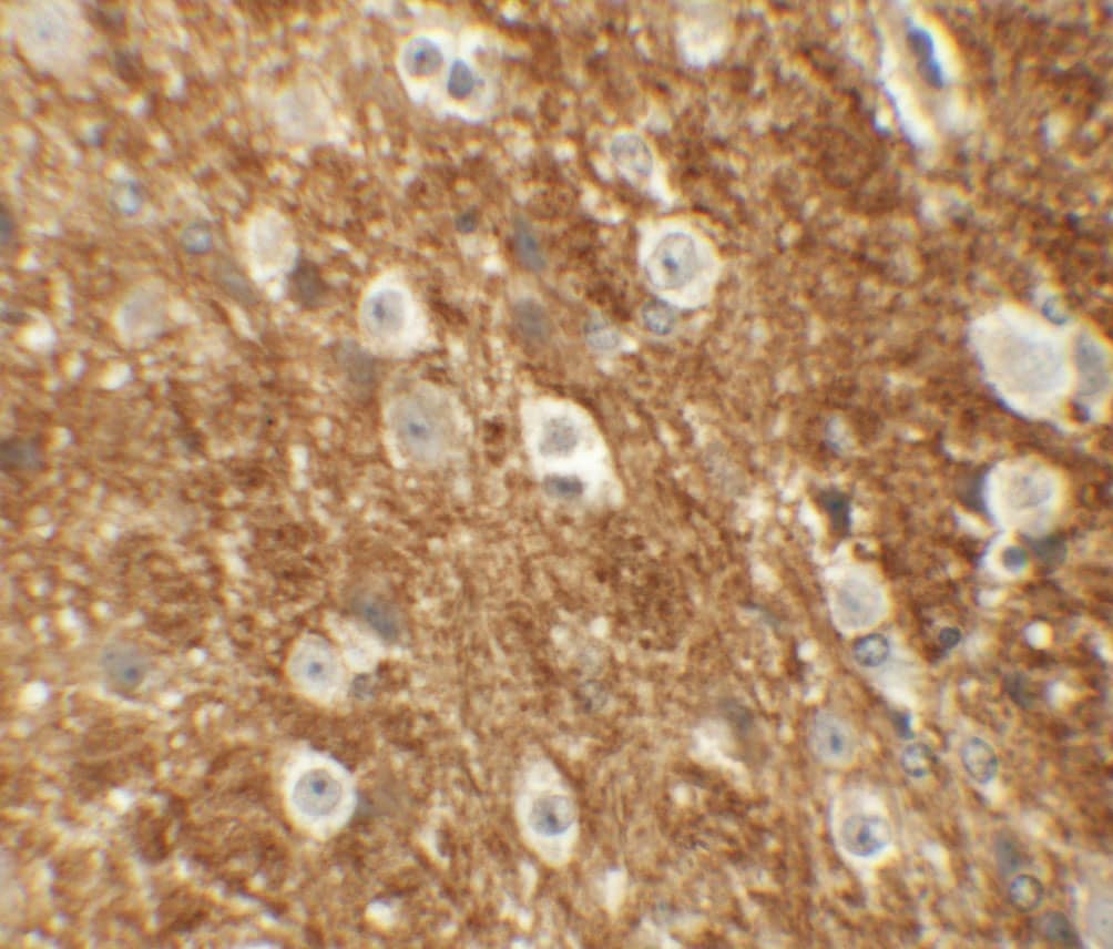 Immunohistochemistry: ROCK2 Antibody - BSA Free [NBP1-76570] - Immunohistochemistry of ROCK2 in mouse brain tissue with ROCK2 antibody at 5 u/mL.