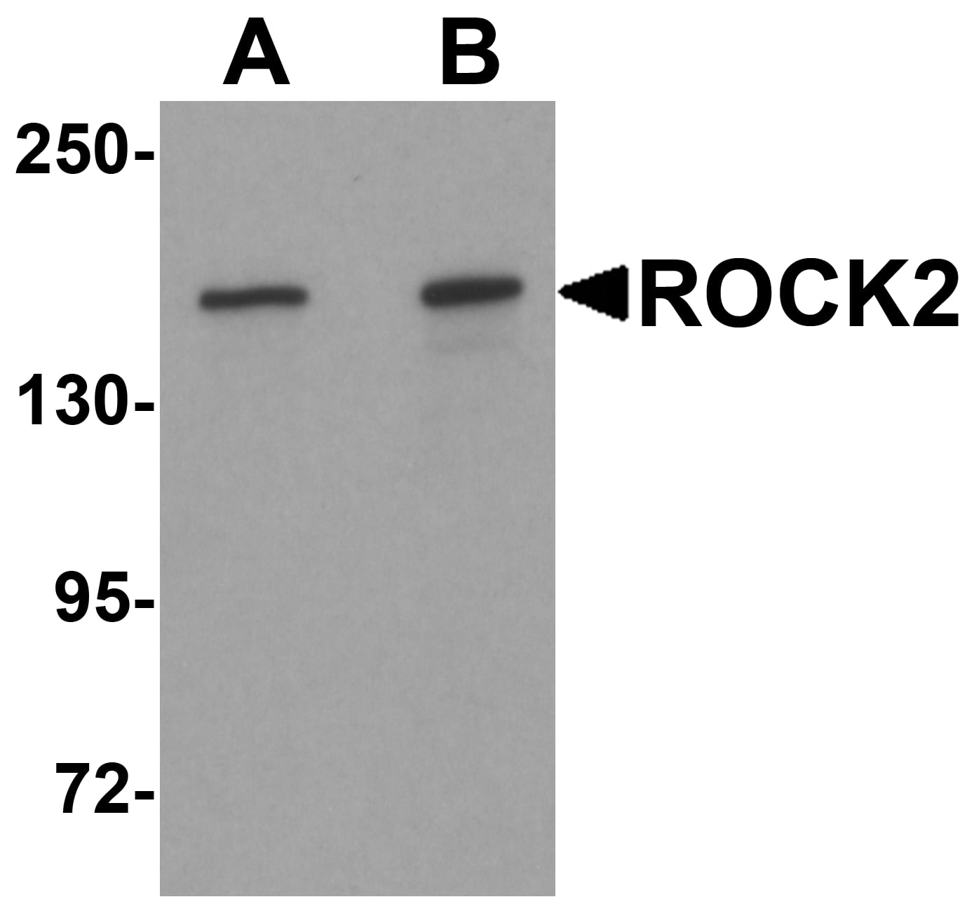 Western Blot: ROCK2 Antibody - BSA Free [NBP1-76570] - Western blot analysis of ROCK2 in mouse brain tissue lysate with ROCK2 antibody at (A) 1 and (B) 2 u/mL