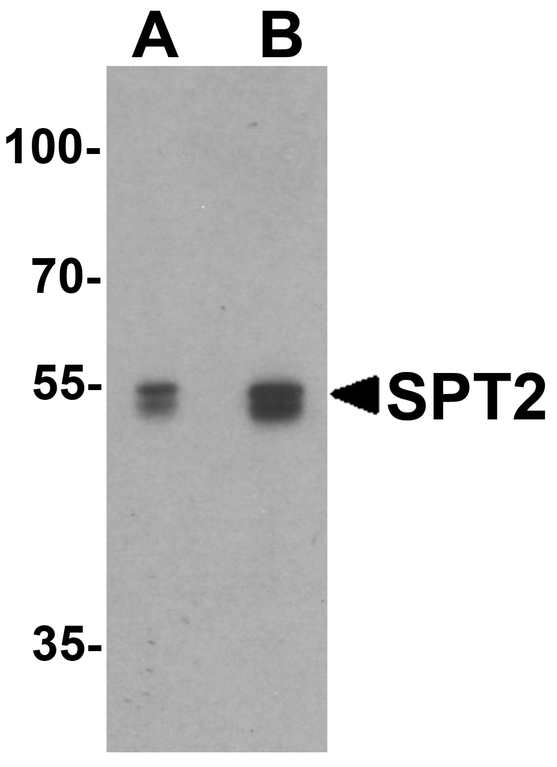 Western Blot: Serine Palmitoyltransferase 2 Antibody - BSA Free [NBP1-76573] - Validation in Mouse 3T3 Cell Lysate in (A) the absence and (B) the presence of blocking peptide. Loading: 15 ug of lysates per lane.Antibodies: Serine Palmitoyltransferase 2,  (0.5 ug/mL), 1h incubation at RT in 5% NFDM/TBST.Secondary: Goat anti-rabbit IgG HRP conjugate at 1:10000 dilution.