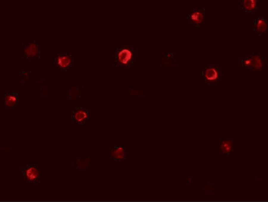 Immunocytochemistry/ Immunofluorescence: IRF4 Antibody - BSA Free [NBP1-76574] - Immunofluorescence of IRF4 in Jurkat cells with IRF4 antibody at 20 u/mL.