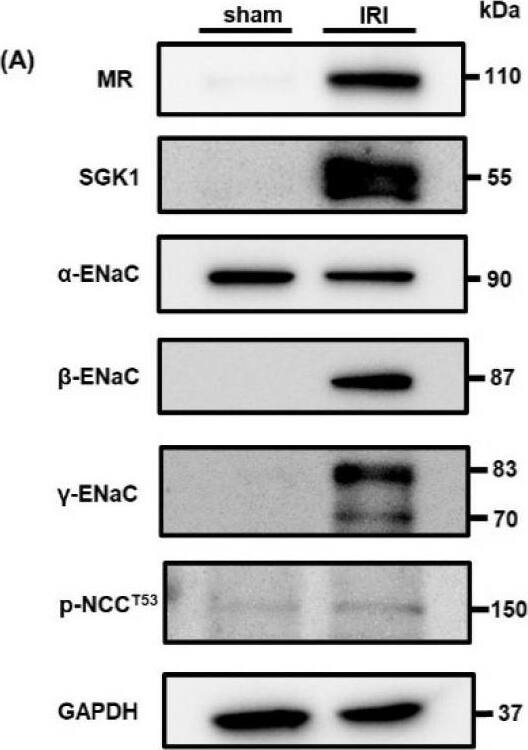 Expression of mineralocorticoid receptor increases in rats 7 days after ischemia–reperfusion injury. Sprague Dawley rats underwent sham or ischemia–reperfusion injury (IRI) surgeries 14 days after right nephrectomy. IRI was induced by clamping the left renal artery. The rats were euthanized on day 7 after the operations, and kidney tissues were collected: (A) Western blots show expression levels of the mineralocorticoid receptor (MR), serum and glucocorticoid-regulated kinase 1 (SGK1),  alpha -epithelial sodium channel ( alpha -ENaC),  beta -ENaC, full-length  gamma -ENaC, cleaved  gamma -ENaC, phospho-NaCl cotransporter channel (Thr53) (p-NCCT53), and glyceraldehyde 3-phosphate dehydrogenase (GAPDH) in kidneys from sham- and IRI-surgery rats. GAPDH was used as a loading control; (B) relative protein levels of MR, SGK1,  alpha -ENaC,  beta -ENaC, full-length  gamma -ENaC, cleaved  gamma -ENaC, and p-NCCT53 in the sham and IRI groups. Band intensities were normalized to GAPDH; (C) plasma aldosterone concentrations in the sham and IRI groups. Values are presented as mean +/- standard error (n = 5 rats per group). Data were analyzed by Student’s t-test for comparisons between two groups. * p < 0.05, ** p < 0.01, *** p < 0.001. Image collected and cropped by CiteAb from the following open publication (//pubmed.ncbi.nlm.nih.gov/35887178), licensed under a CC-BY license. Not internally tested by Novus Biologicals.