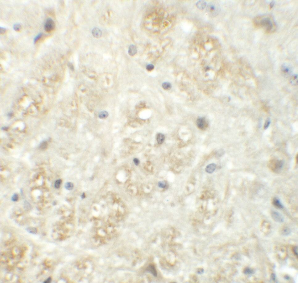 Immunohistochemistry Vasohibin Antibody - BSA Free