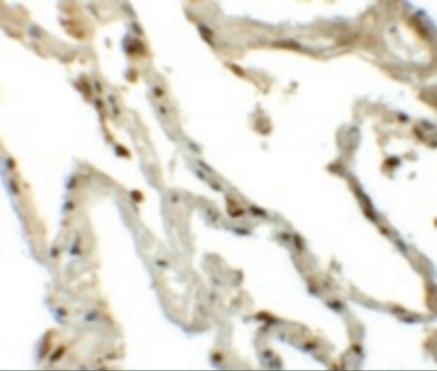 Immunohistochemistry Translin Antibody - BSA Free