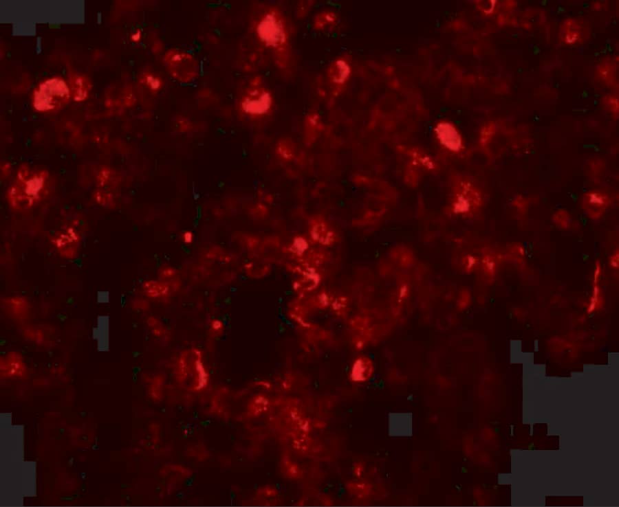 Immunocytochemistry/ Immunofluorescence: Translin Antibody - BSA Free [NBP1-76581] - Immunofluorescence of Translin in human lung tissue with Translin antibody at 20 ug/mL.