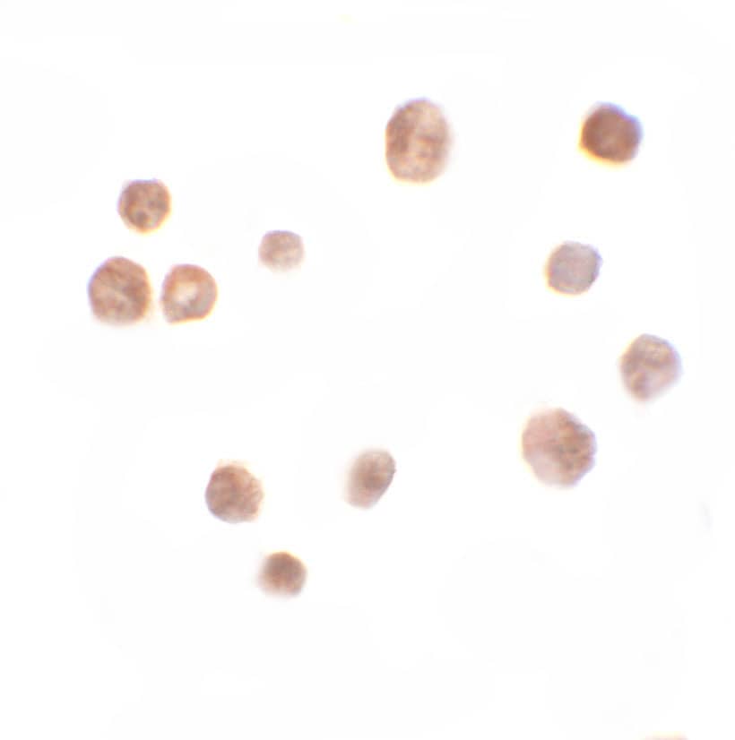 Immunocytochemistry/ Immunofluorescence: TRMT12 Antibody - BSA Free [NBP1-76583] - Immunocytochemistry of TRMT12 in K562 cells with TRMT12 antibody at 10 ug/mL.