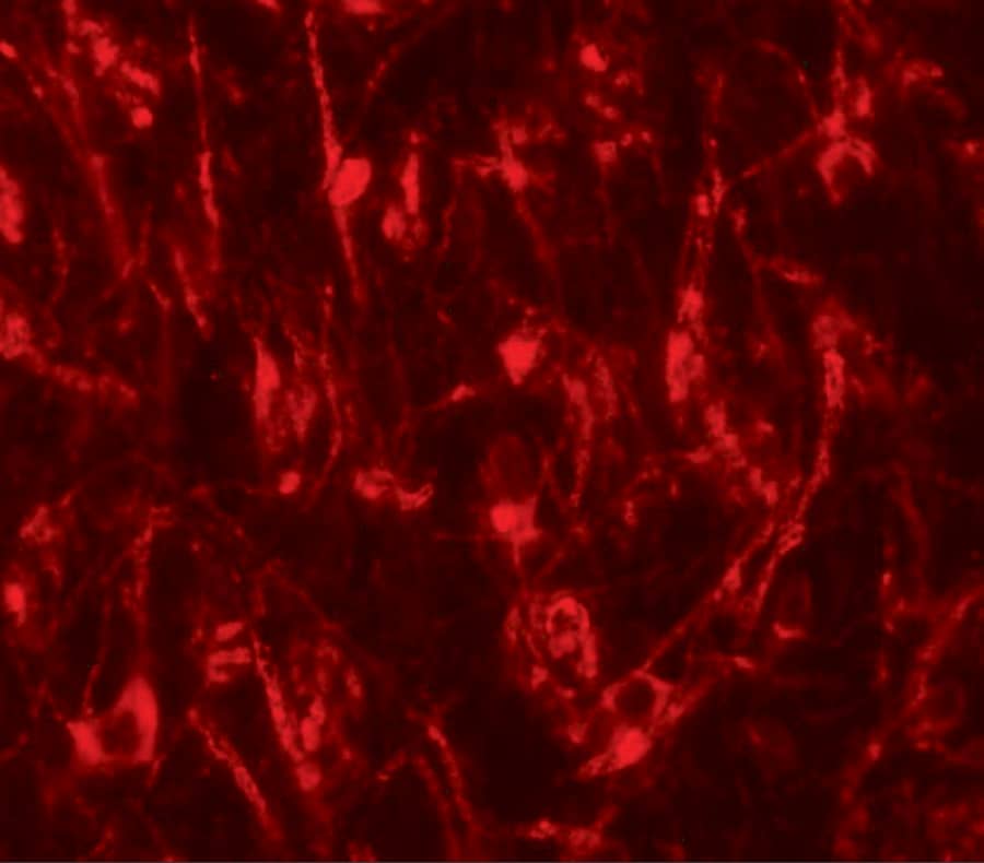 Immunocytochemistry/ Immunofluorescence LCMT2 Antibody - BSA Free