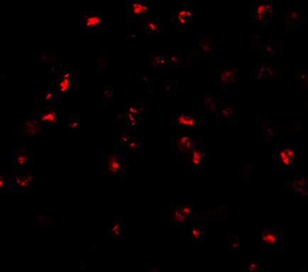 Immunocytochemistry/ Immunofluorescence: ATAD3A Antibody - BSA Free [NBP1-76586] - Immunofluorescence of ATAD3A in Daudi cells with ATAD3A antibody at 20 ug/mL.