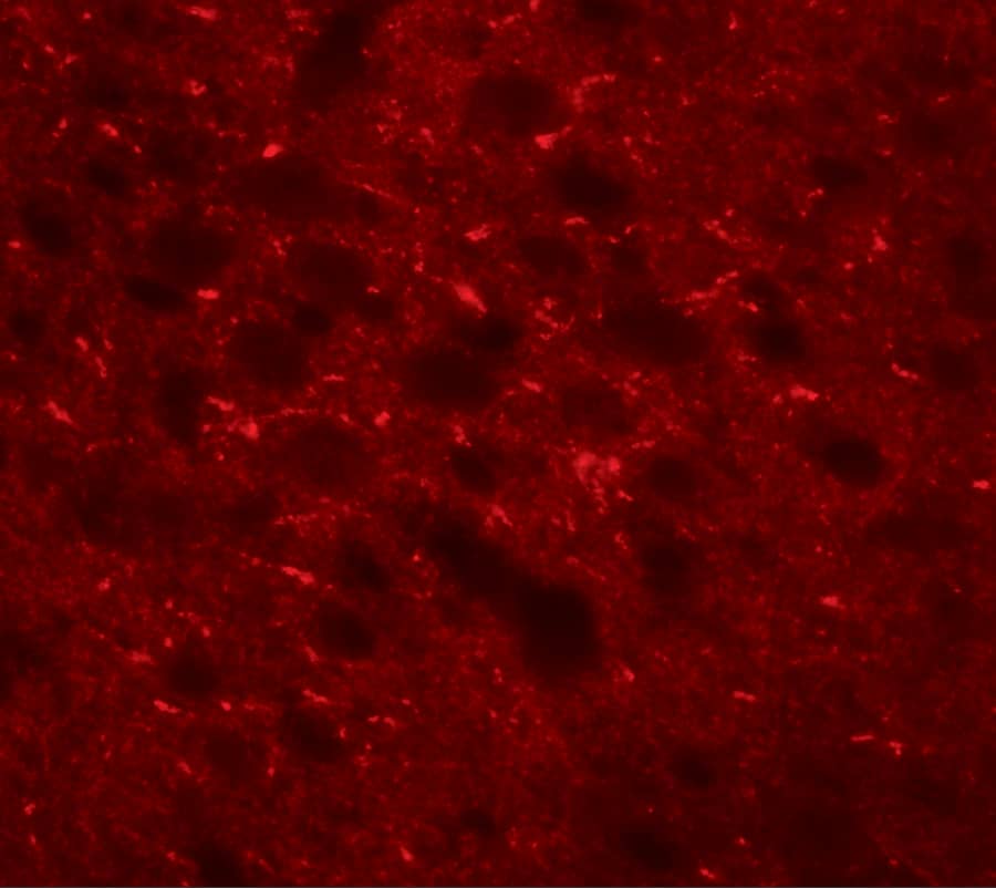 Immunocytochemistry/ Immunofluorescence TMEM88 Antibody - BSA Free