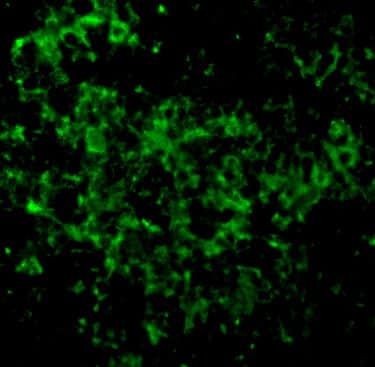 Immunocytochemistry/ Immunofluorescence: UBE2N/Ubc13 Antibody - BSA Free [NBP1-76593] - Immunofluorescence of UBE2N/Ubc13 in Mouse Thymus cells with UBE2N/Ubc13 antibody at 10 u/mL.